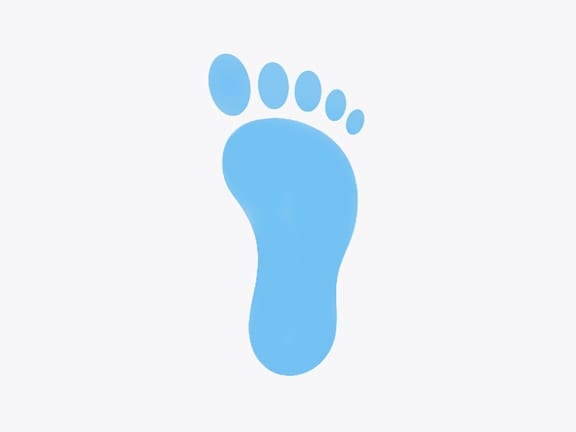 Illustration of a flat feet / low arch wet footprint