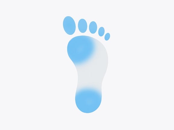 Illustration of a high arch wet footprint